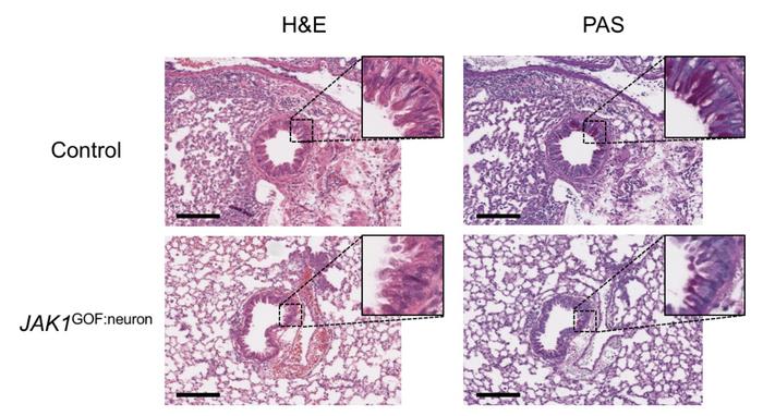 Mice engineered with a patient gene (JAK1 GOF: Neuron) show less lung inflammation, fewer immune cells, and reduced mucous production compared to controls CREDIT: Kim et al., Cell.